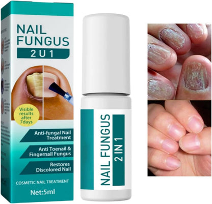 Jaysuin - Nail Fungus Spray